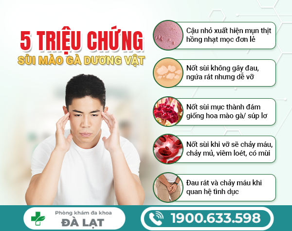 Hình ảnh minh họa